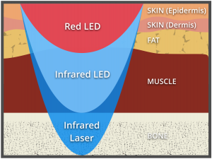 Various depths reached by BioFlex Cold Laser Therapy