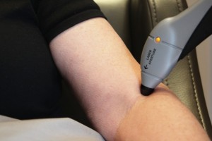 Cold Laser Therapy: Epicondylitis Treatment - Step 3 Infrared Wand