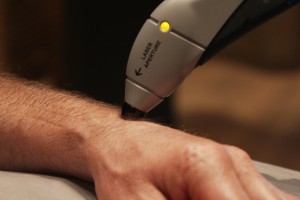 Cold Laser Therapy Wrist Pain Treatment: Step 3