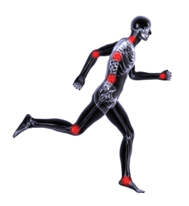 Common areas of osteoarthrtitis