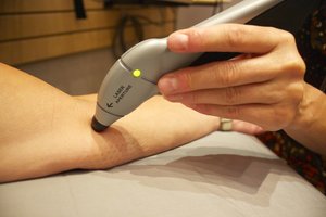 Cold laser therapy elbow wand