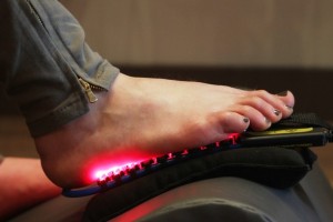 Cold Laser Therapy Foot Pain Treatment: Step 1