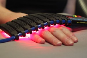 Cold Laser Therapy Hand Pain Treatment: Step 1