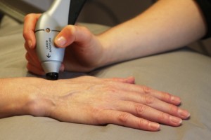 Cold Laser Therapy Hand Pain Treatment: Step 3